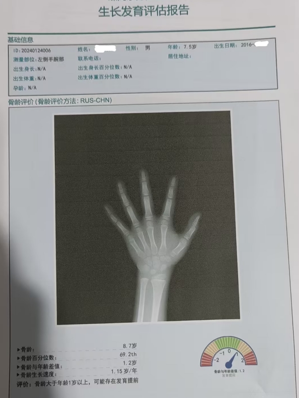 骨齡和身高有什么關(guān)系？每個(gè)孩子都有必要檢測嗎？